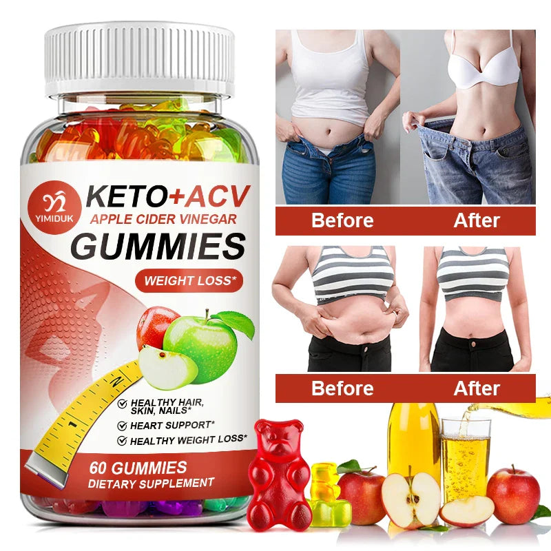 New Keto Apple Cider Vinegar Gummies for Weight